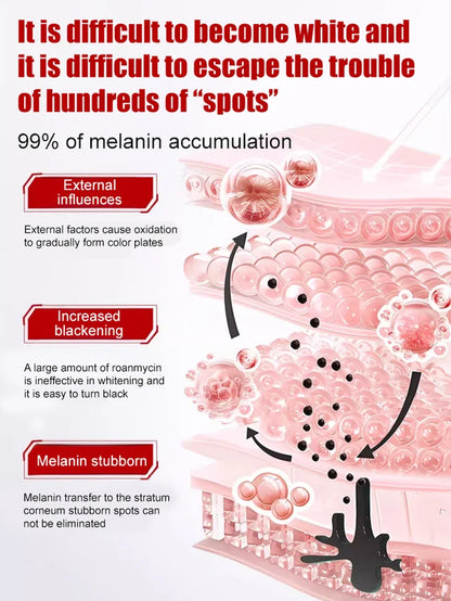 Dark Spot Corrector 🔥Hot Sales Now 49% OFF🔥🎉