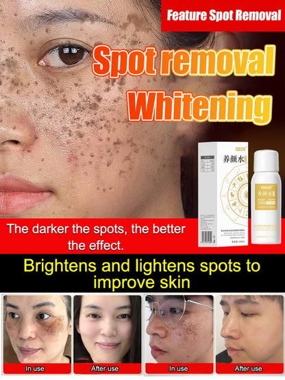 Dark Spot Corrector 🔥Hot Sales Now 49% OFF🔥🎉