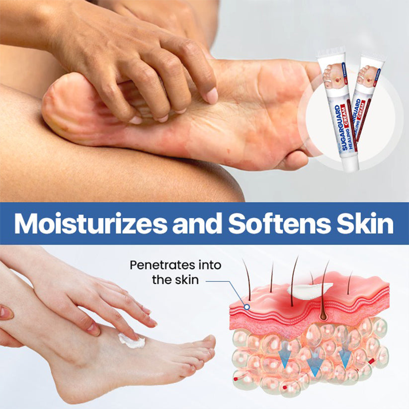 Cvreoz® SugarGuard Healing Cream