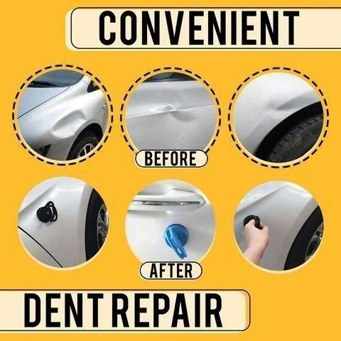 Advance Dent Puller (Assorted Colour)